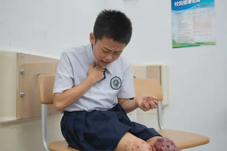 中學(xué)生腳上長(zhǎng)濕疹不管它會(huì)自己痊愈嗎(圖4)