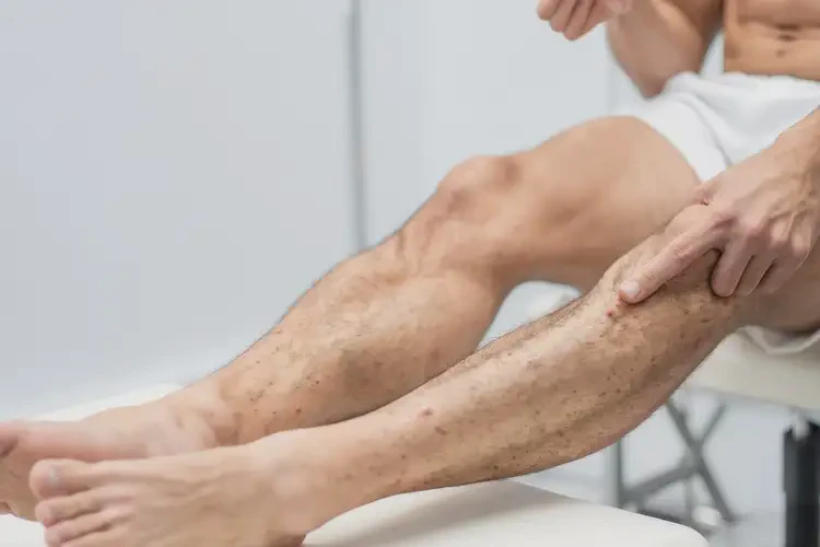 青年人大腿出現(xiàn)濕疹能夠徹底治愈嗎(圖4)