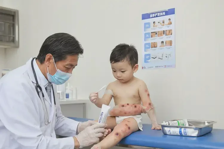 小孩屁股经常起湿疹可以彻底自愈吗(图2)