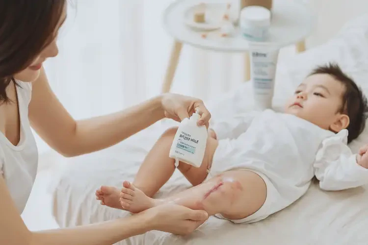 寶寶小腿有濕疹可以徹底自愈嗎(圖3)