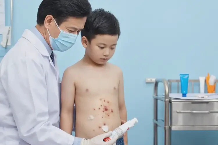 小兒肚子起濕疹能徹底自愈嗎(圖3)