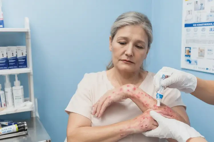 女人手上長濕疹不管它會自己自愈嗎(圖2)