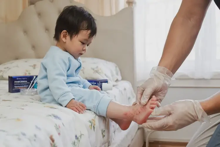 幼兒腳上經(jīng)常長濕疹能徹底自愈嗎(圖2)