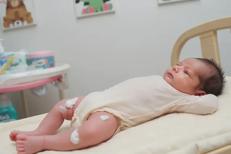 新生兒大腿上出濕疹能靠自己自愈嗎(圖1)