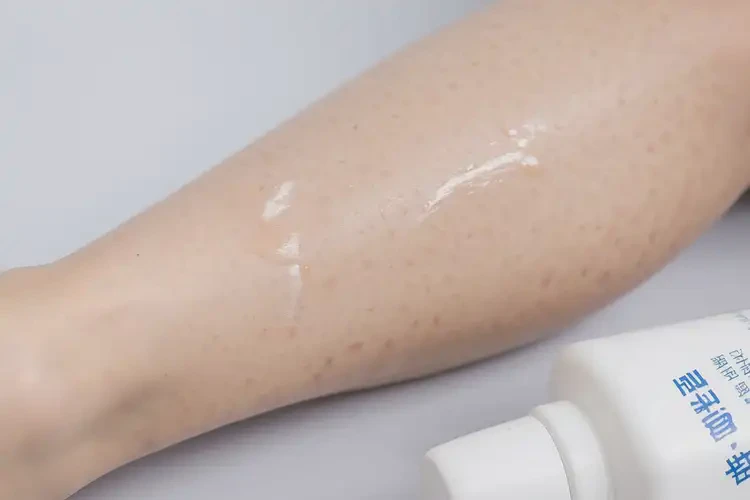 小孩小腿容易起濕疹可以徹底自愈嗎(圖3)