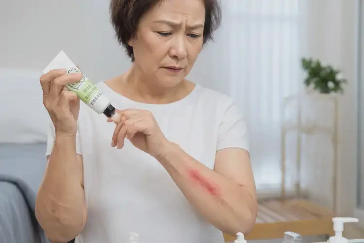 女生四肢偶爾起濕疹不管它會(huì)自己痊愈嗎(圖3)