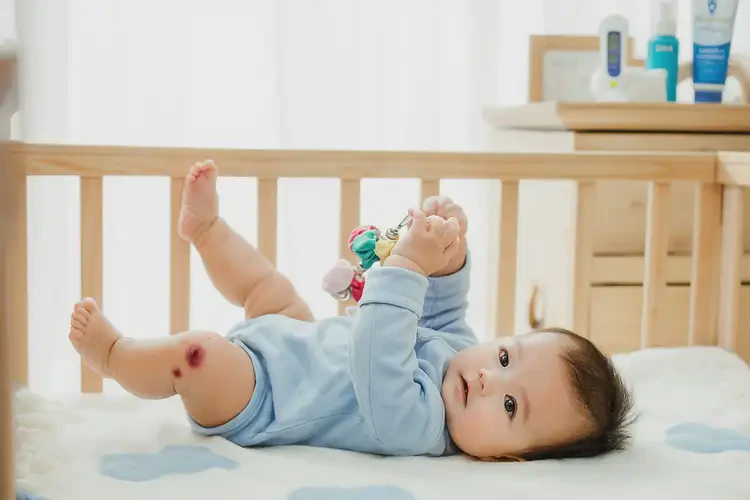 寶寶小腿有濕疹可以徹底自愈嗎(圖1)