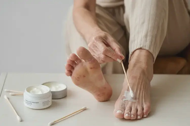 男生腳上出現(xiàn)濕疹能夠徹底治愈嗎(圖2)