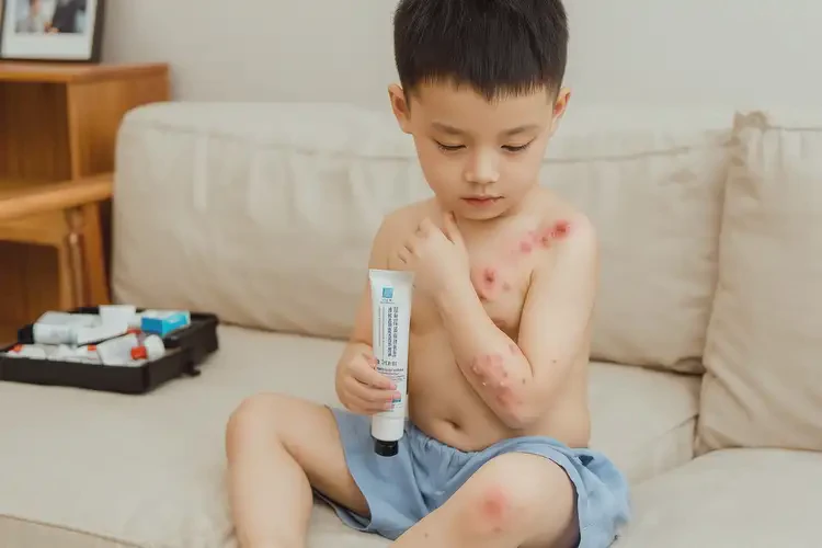 少兒屁股經(jīng)常起濕疹不管它會(huì)自己好嗎(圖3)