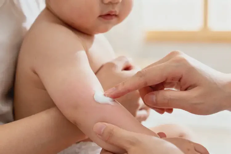 寶寶手臂偶爾長濕疹能夠徹底治愈嗎(圖3)