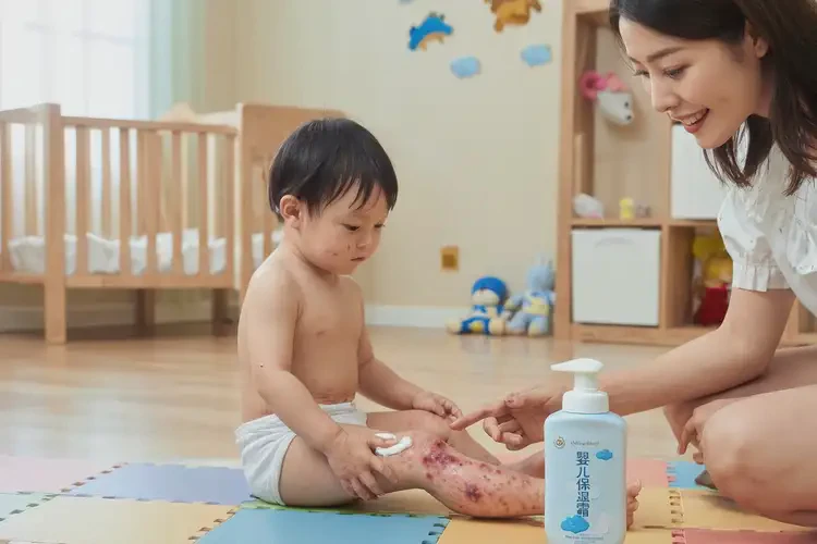 幼兒大腿經(jīng)常長濕疹不管它會自己痊愈嗎(圖3)