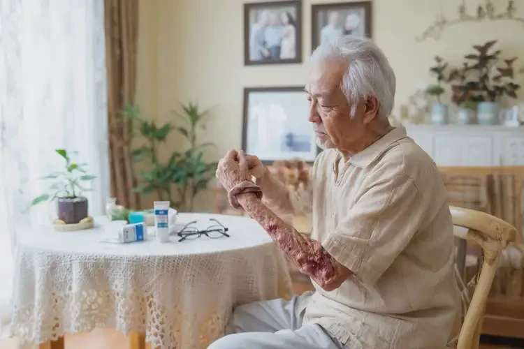 高齡老人手臂長濕疹可不可以徹底自愈(圖1)