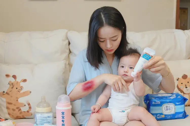 哺乳期媽媽屁股上起濕疹能徹底自愈嗎(圖3)