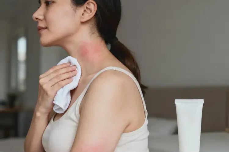 哺乳期媽媽脖子有濕疹不管它會(huì)自己痊愈嗎(圖2)