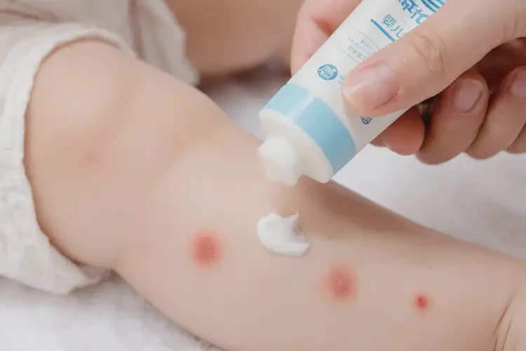 嬰兒小腿經(jīng)常起濕疹可不可以徹底自愈(圖3)