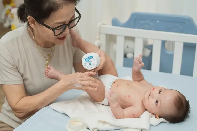 新生兒大腿容易起濕疹能徹底自愈嗎(圖3)