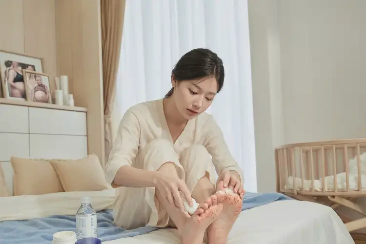 產(chǎn)婦腳上出濕疹不管它會自己痊愈嗎(圖2)