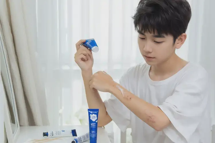 青少年全身容易起濕疹可以徹底自愈嗎(圖4)