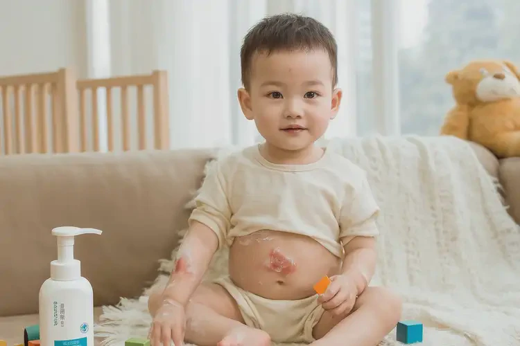 幼兒肚子上偶爾長濕疹能不能徹底自愈(圖2)