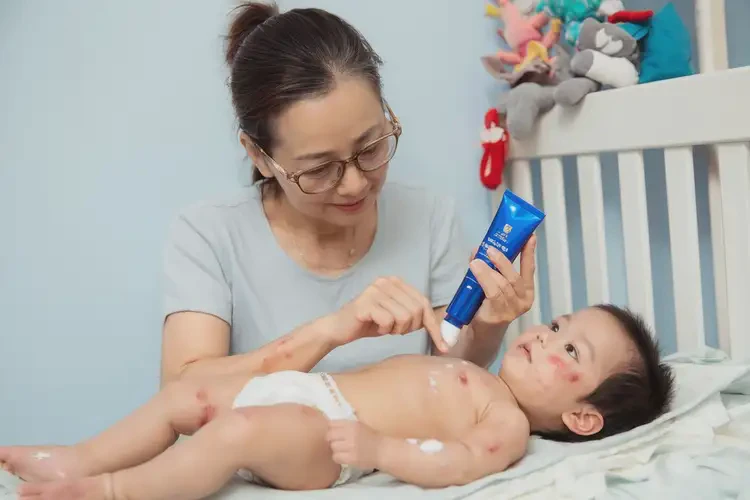 兒童屁股上偶爾長(zhǎng)濕疹不管它會(huì)自己好嗎(圖3)