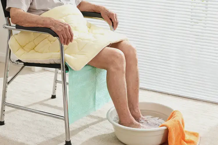 老人屁股上出湿疹可以彻底自愈吗(图1)