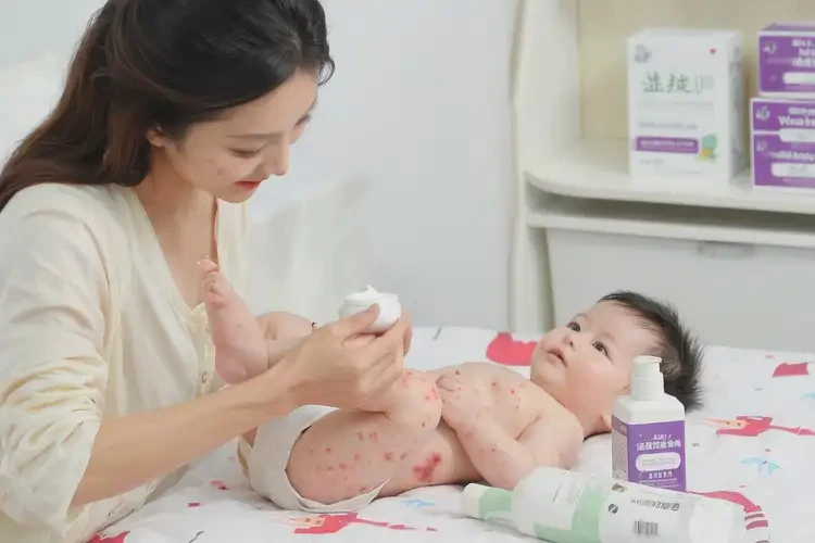 婴幼儿四肢容易起湿疹能靠自己自愈吗(图3)