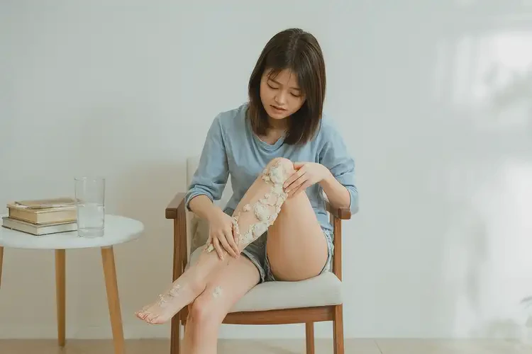 女生小腿偶尔长湿疹可以彻底自愈吗(图2)