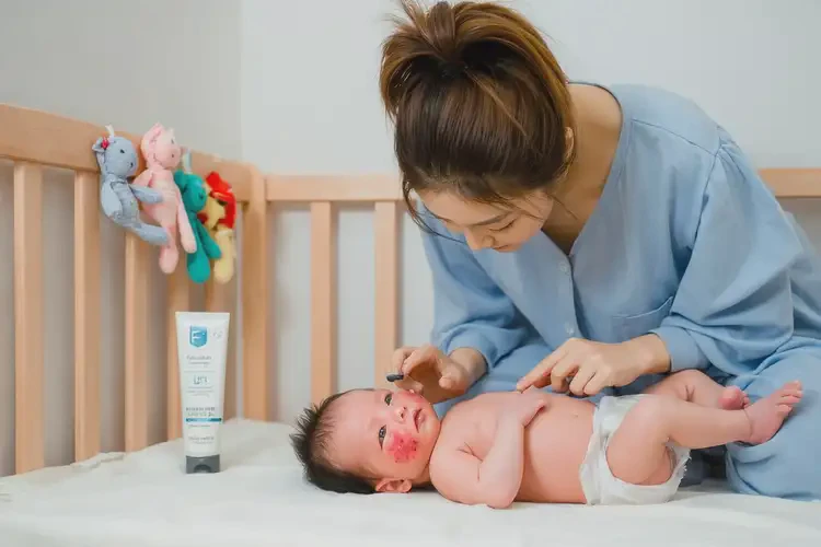 新生兒全身出現(xiàn)濕疹能靠自己自愈嗎(圖3)