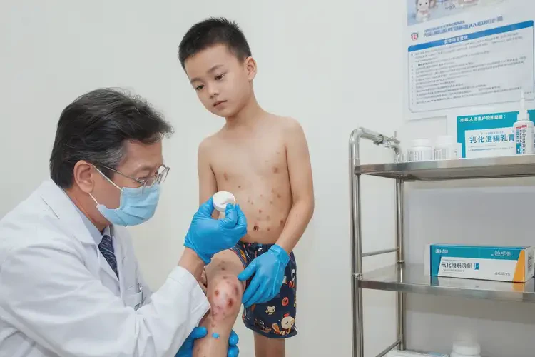 孩子大腿上出濕疹不管它會自己自愈嗎(圖1)
