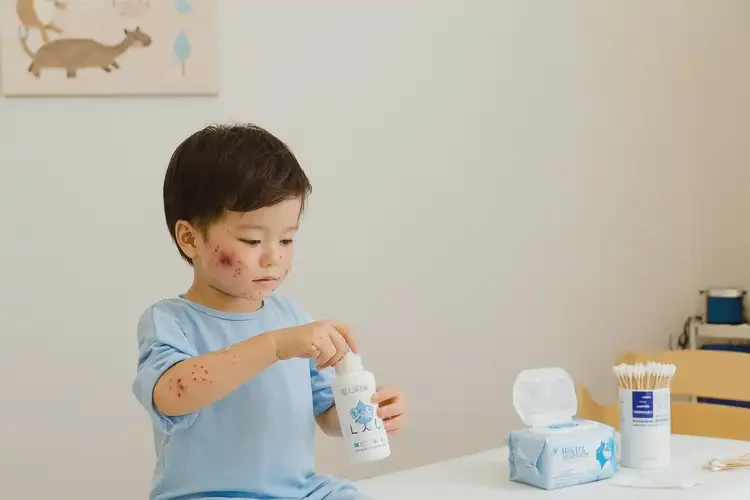 少儿身上偶尔长湿疹不管它会自己痊愈吗(图2)