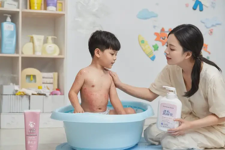 少兒全身容易起濕疹能夠徹底治愈嗎(圖4)