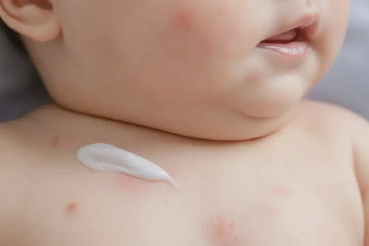 小孩脖子上偶爾起濕疹可不可以徹底自愈(圖4)