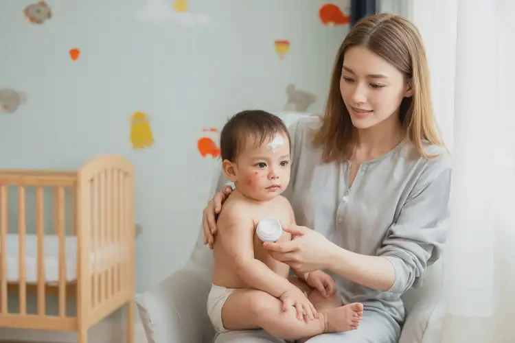 寶寶臉上偶爾長(zhǎng)濕疹能徹底自愈嗎(圖3)