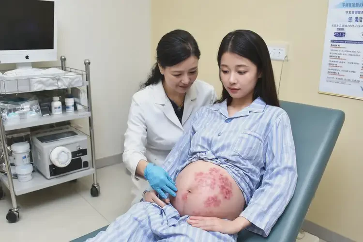 產(chǎn)婦肚子偶爾起濕疹能徹底自愈嗎(圖1)