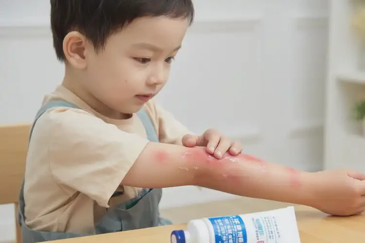 幼兒手臂容易起濕疹不管它會自己好嗎(圖3)