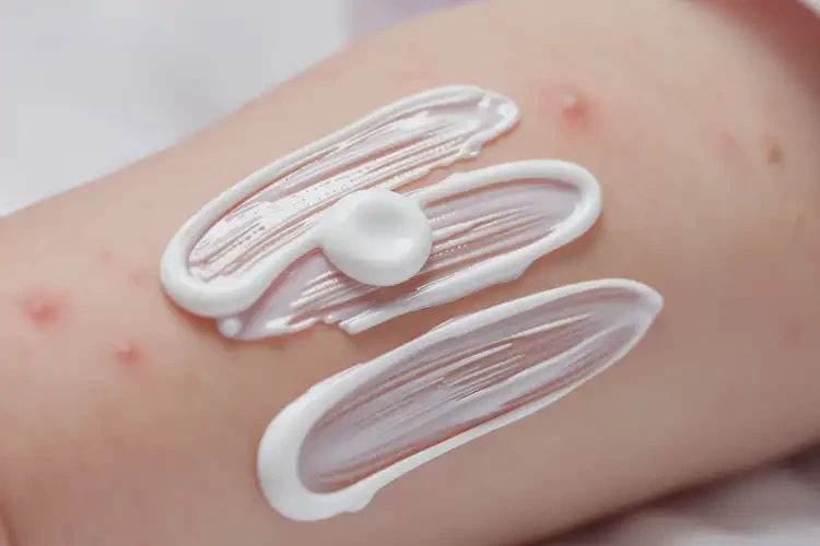 嬰幼兒手臂上偶爾起濕疹能夠徹底治愈嗎(圖2)