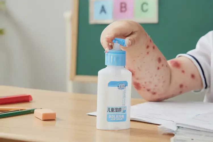 小学生手上容易长湿疹不管它会自己自愈吗(图3)