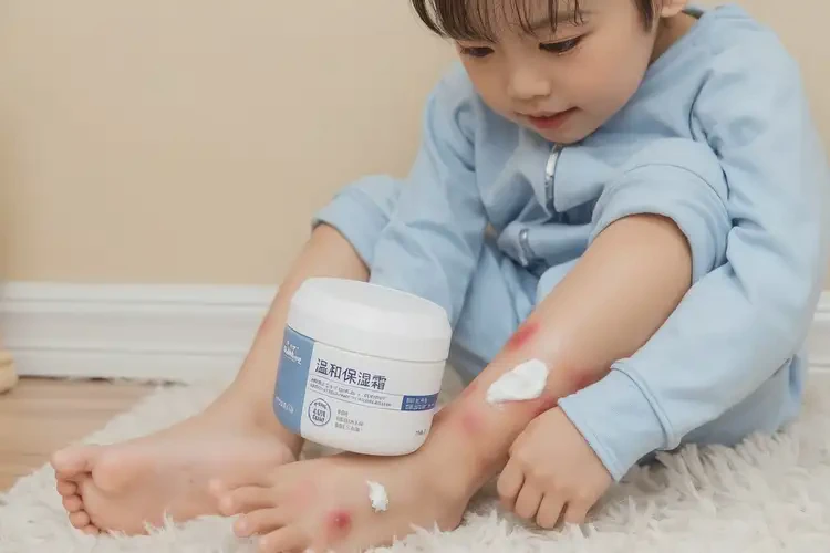 兒童小腿上經(jīng)常起濕疹不管它會(huì)自己好嗎(圖1)