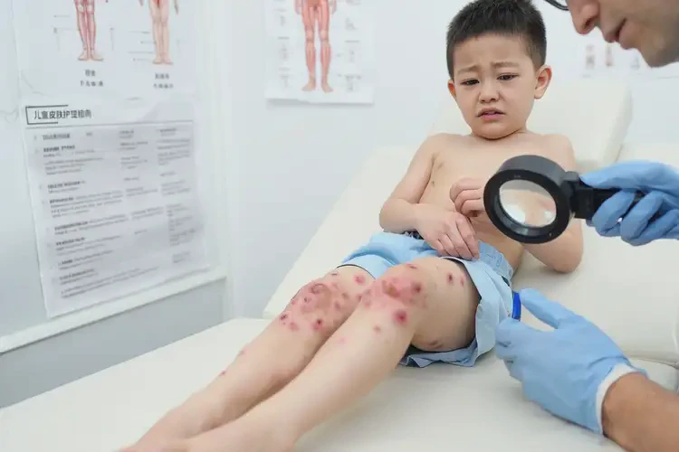 小兒大腿上起濕疹能徹底自愈嗎(圖4)