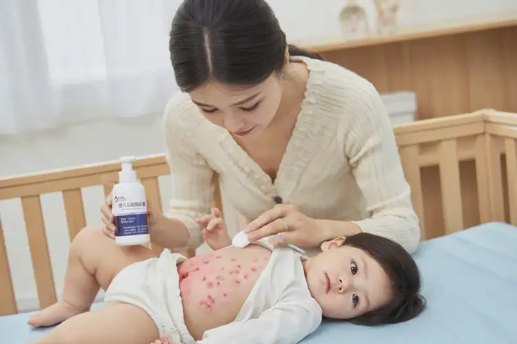 幼兒肚子經(jīng)常起濕疹不管它會(huì)自己自愈嗎(圖3)