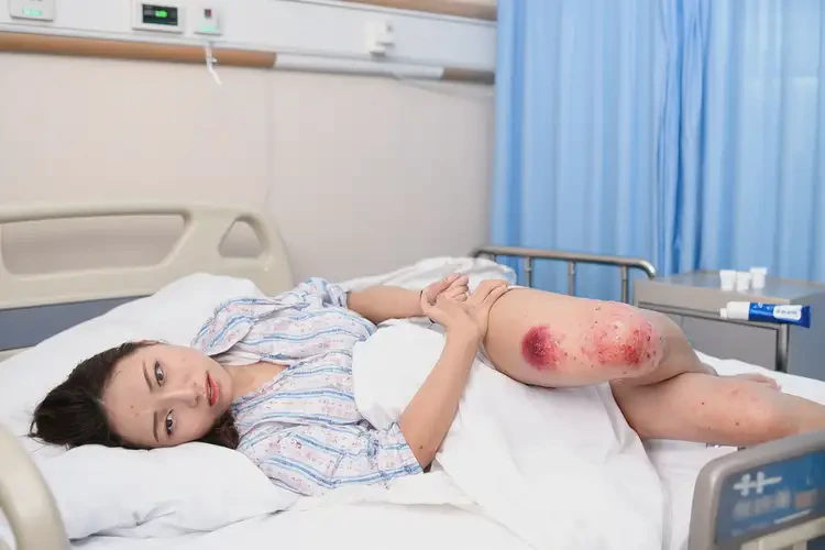 產(chǎn)婦小腿長濕疹能靠自己自愈嗎(圖3)