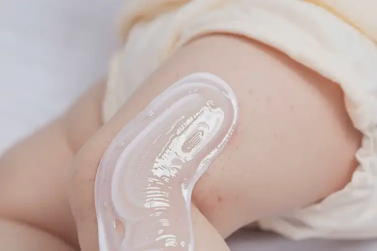 寶寶小腿容易長(zhǎng)濕疹不管它會(huì)自己痊愈嗎(圖2)