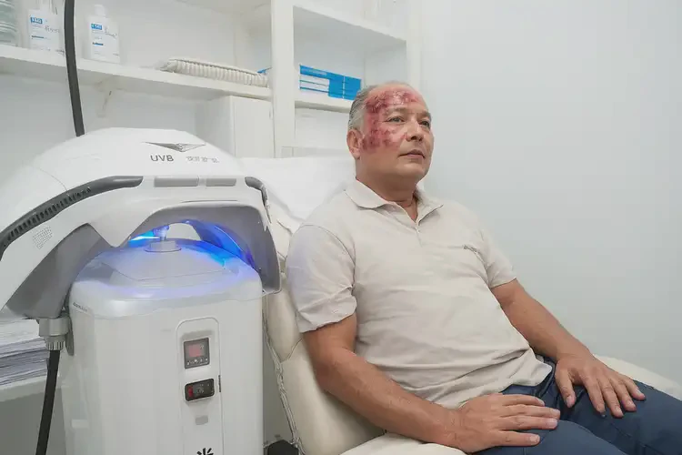 男性脖子上出現(xiàn)濕疹能靠自己自愈嗎(圖2)