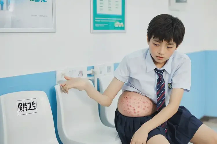 青少年屁股出現(xiàn)濕疹能不能徹底自愈(圖4)