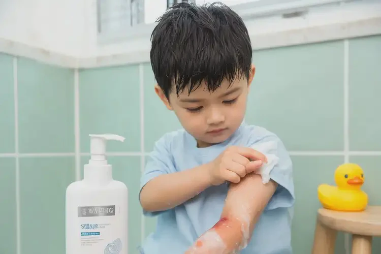 小兒手臂上容易起濕疹能夠徹底治愈嗎(圖2)