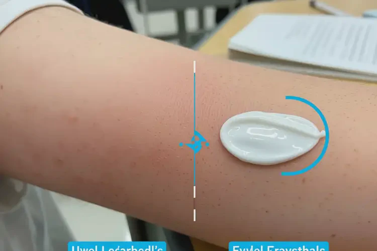 中學生手臂起濕疹能靠自己自愈嗎(圖2)