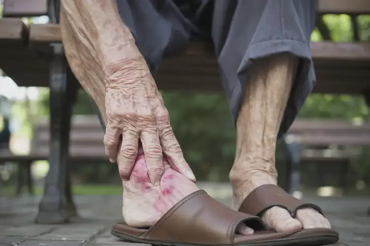 老年人腳上偶爾起濕疹不管它會自己好嗎(圖4)