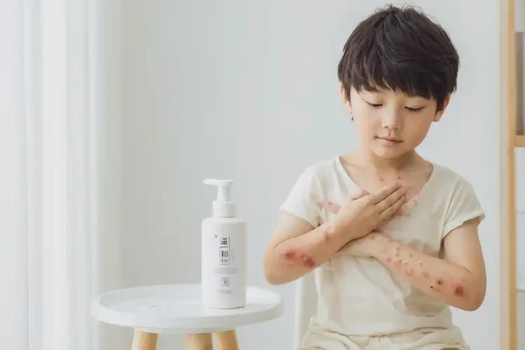 小孩脖子上有濕疹能徹底自愈嗎(圖3)