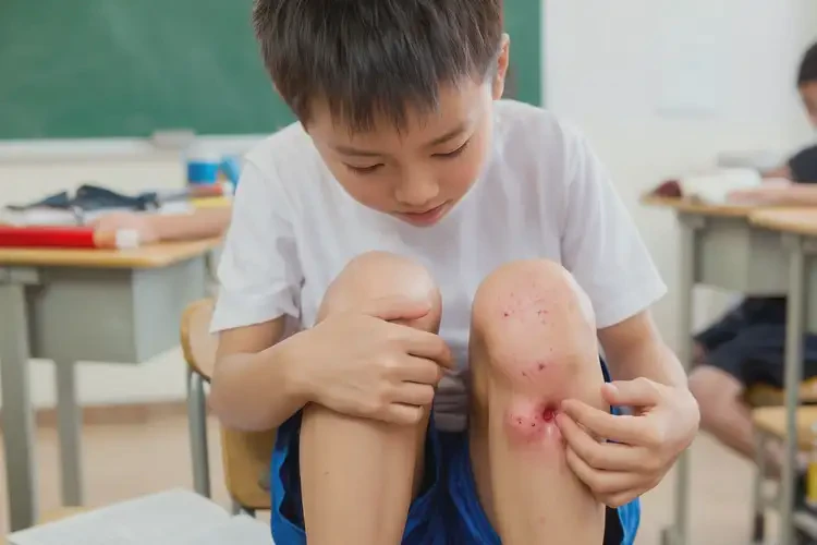 小學(xué)生大腿偶爾長(zhǎng)濕疹能靠自己自愈嗎(圖4)