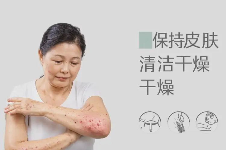 中学生肚子上有湿疹能靠自己自愈吗(图4)